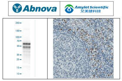说明书丨Abnova艾美捷RUNX2 单克隆抗体