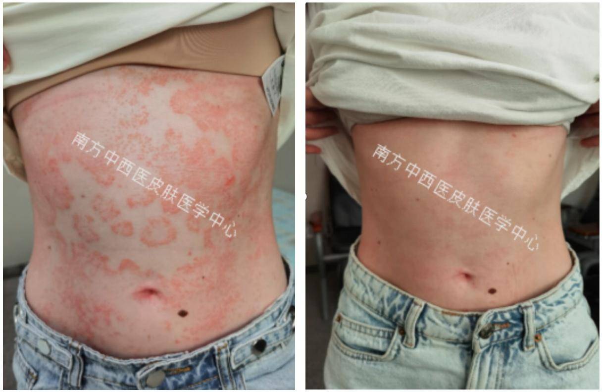 中医药再发威<strong></p>
<p>西安市诚信平台交易中心</strong>，1个月让23岁美国姑娘走出“银”影