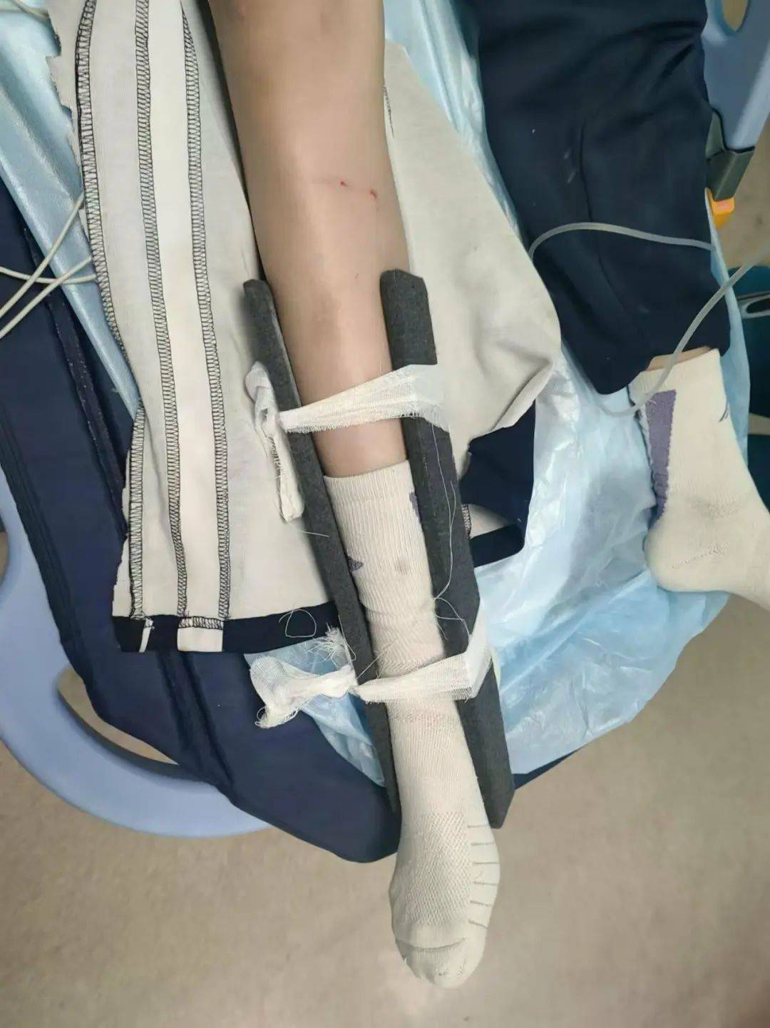 惨痛<strong></p>
<p>币兑交易平台</strong>！一人身亡！深圳多名学生骑电动车发生意外