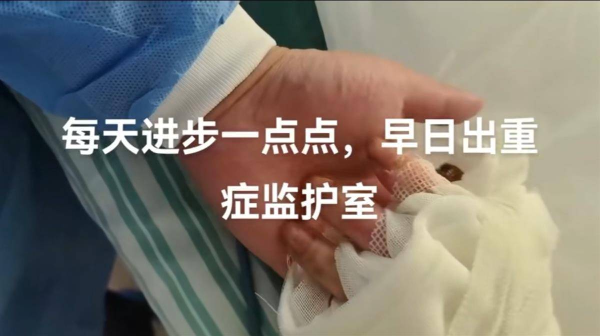 “烧伤妈妈”术后首次开口说话<strong></p>
<p>炒原油交易平台</strong>，称一辈子的苦都吃完了，其丈夫已开始带货，512件好物有497人跟买