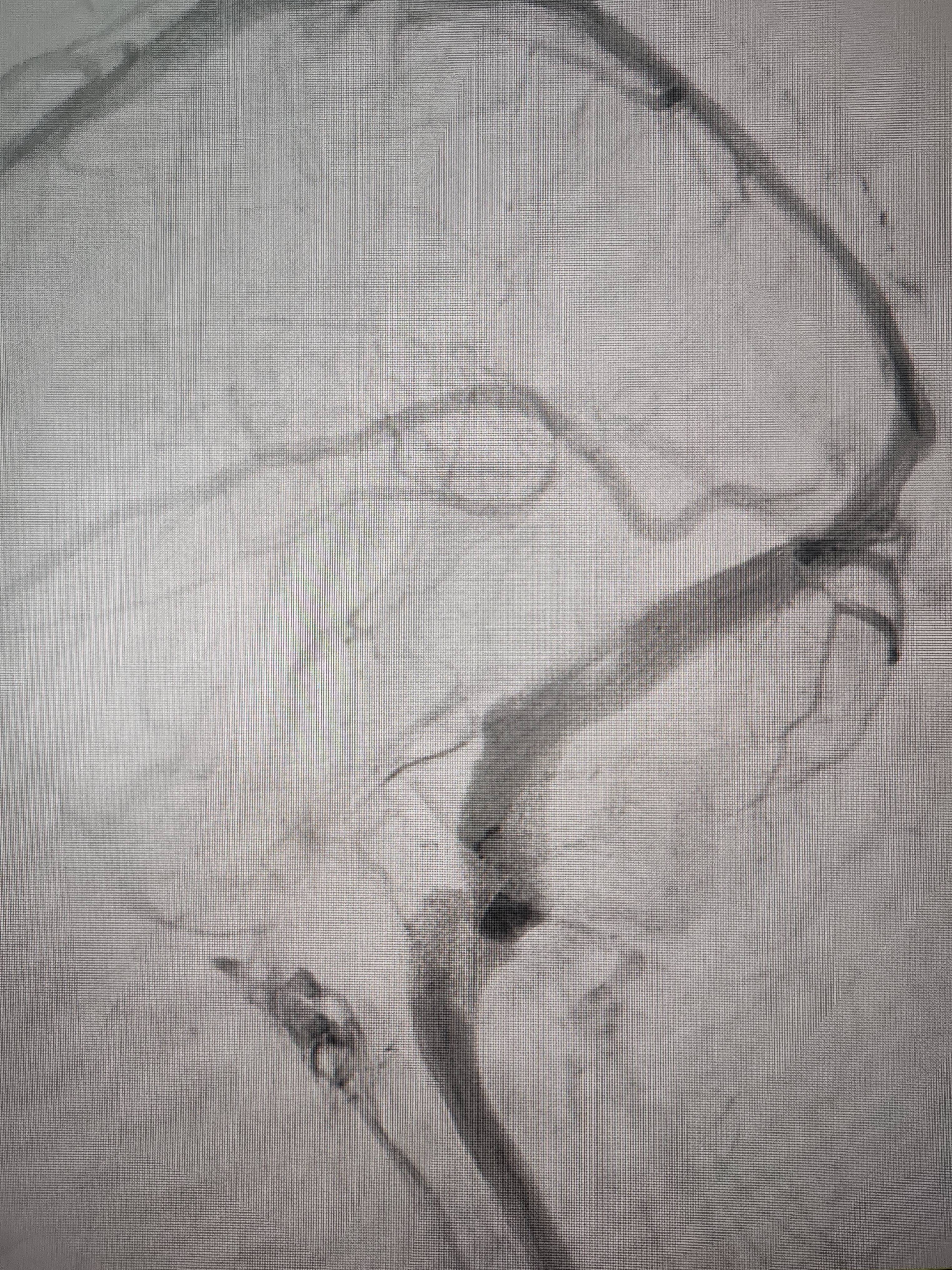 吉林女子患罕见耳鸣7年<strong></p>
<p>BFX合约平台</strong>，慕名千里来顺德寻医终获新生
