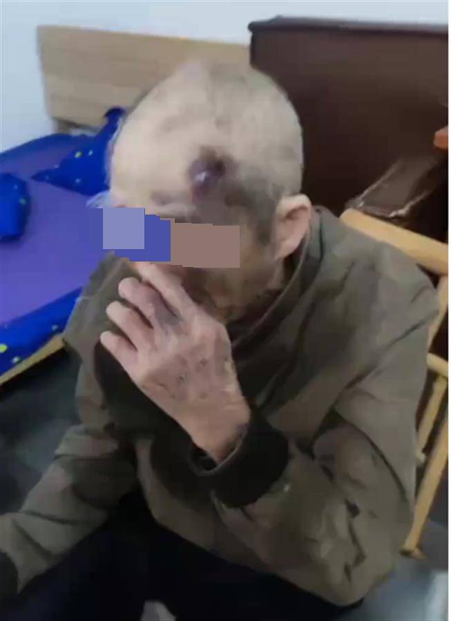 广东阳江一养老院护工长期虐待九旬老人？民政局已介入<strong></p>
<p>公信宝gxs交易平台</strong>，警方：正了解情况