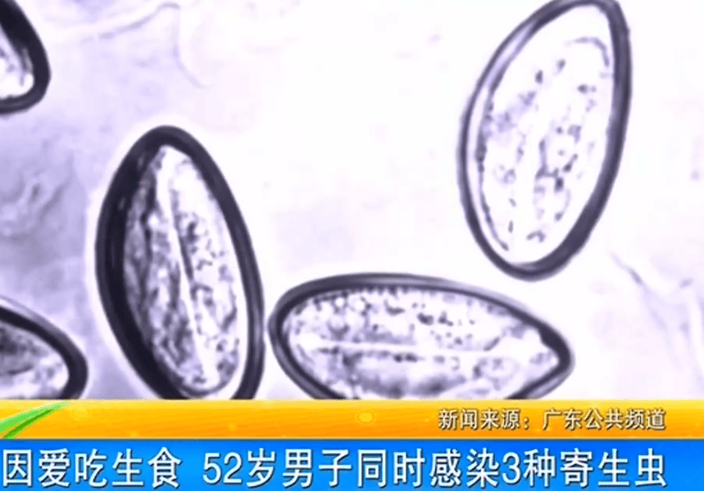 女子体内排出10米长绦虫<strong></p>
<p>群币交易平台</strong>！原是两年前旅游时吃了这种食物