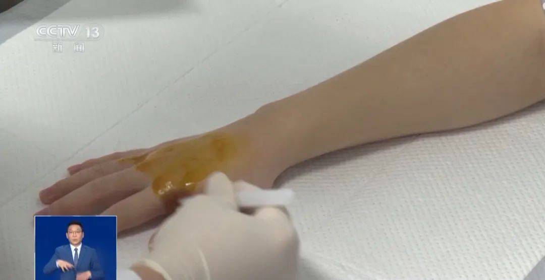 南方游客在哈尔滨“泼水成冰”受伤<strong></p>
<p>币圈平台</strong>！最新提醒