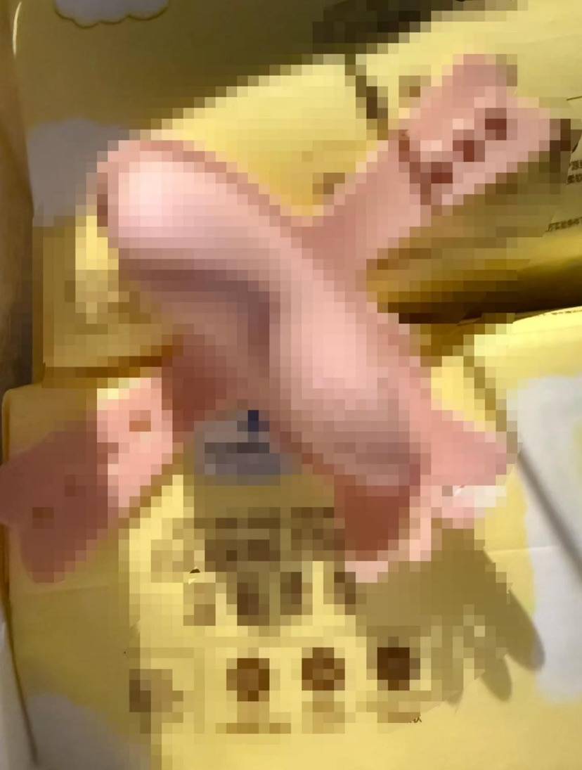 共享单车坐垫内有成人用品<strong></p>
<p>otc交易平台</strong>？运营商哈啰：已向事发属地派出所报案