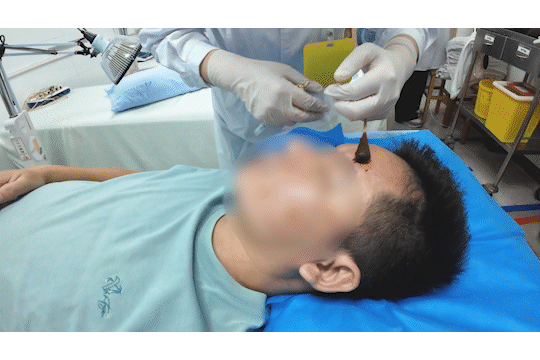 醒来“天塌了”<strong></p>
<p>宁夏电力交易中心平台</strong>！深圳一女子眼睛闭不上、嘴巴漏水！这些错误很多人会犯