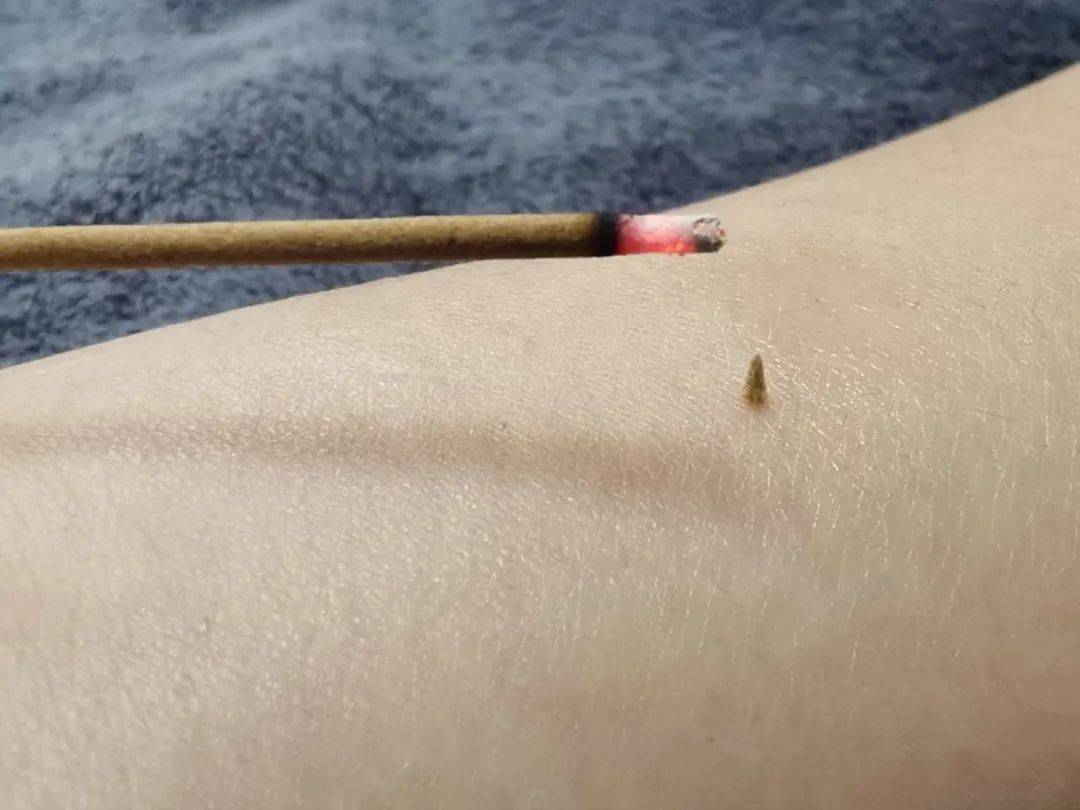 醒来“天塌了”<strong></p>
<p>宁夏电力交易中心平台</strong>！深圳一女子眼睛闭不上、嘴巴漏水！这些错误很多人会犯