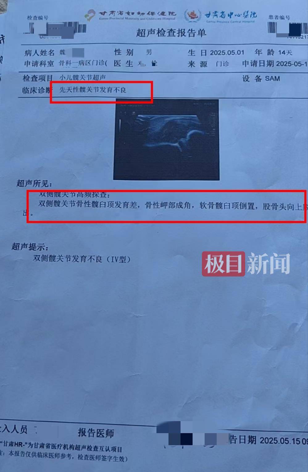 二胎出生查出先天性病症或落下残疾<strong></p>
<p>买币平台</strong>，残疾父母称医院产检漏检、未尽告知义务，医院及医调委回应