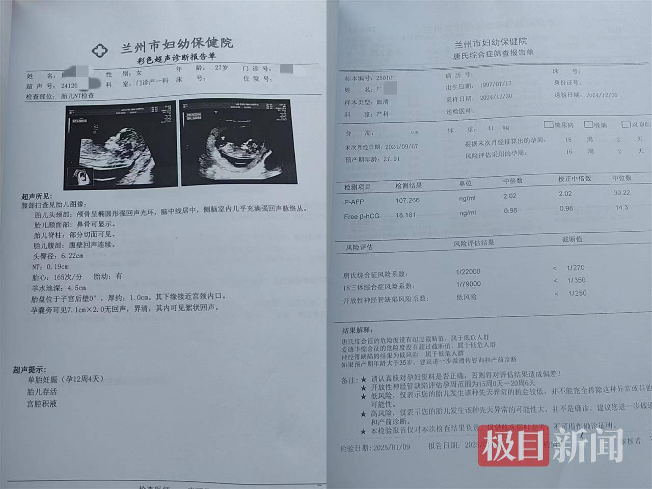 二胎出生查出先天性病症或落下残疾<strong></p>
<p>买币平台</strong>，残疾父母称医院产检漏检、未尽告知义务，医院及医调委回应