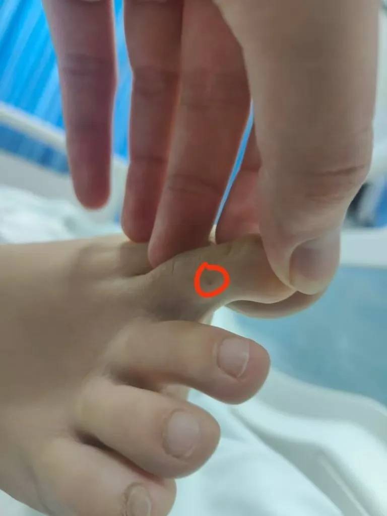 女子疑被蛇咬身亡事件进展：家属正在酒店收拾逝者遗物<strong></p>
<p>买币平台</strong>，称暂无处置结果