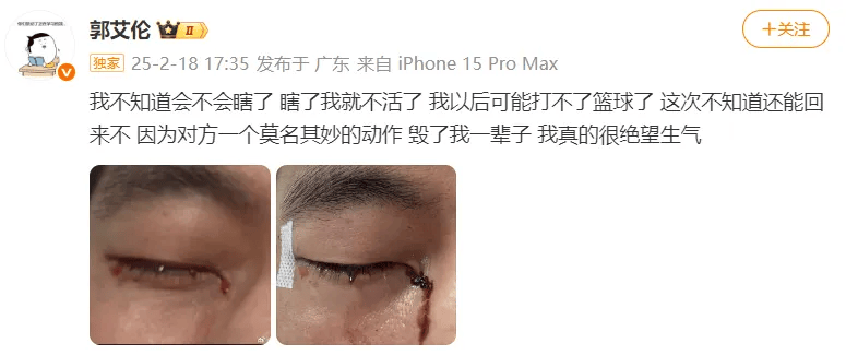 31岁郭艾伦直言想回国家队<strong></p>
<p>诚币网</strong>，但应该没什么机会了，此前眼睛被队友误伤，缝了40多针