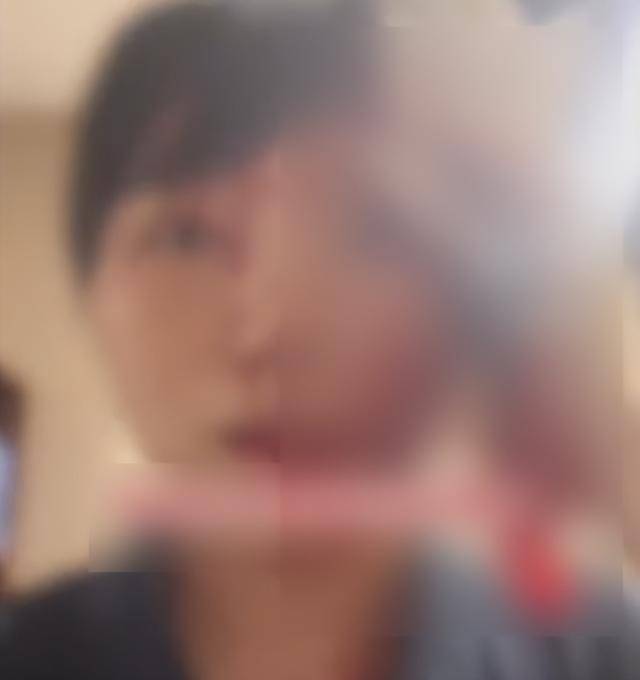 缝了20多针！女子称被不知名男同事砸头毁容<strong></p>
<p>云币商城</strong>，警方介入