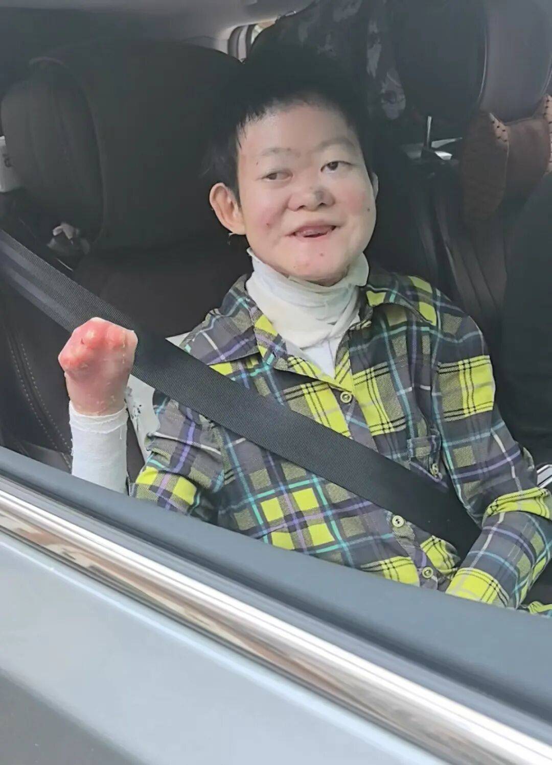 医生断言“活不过2岁”的郑州罕见病女孩<strong></p>
<p>上币费用</strong>，24岁“带伤出征”，开启西藏之行