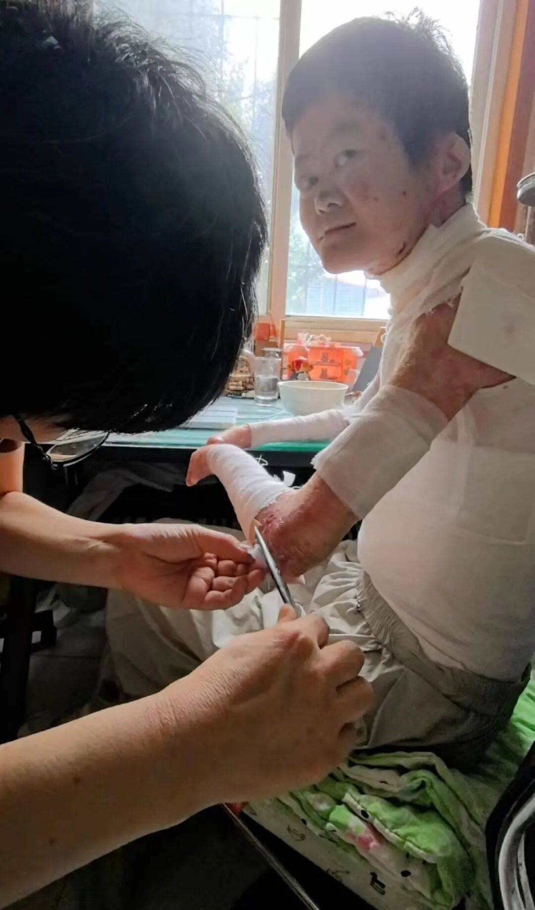 医生断言“活不过2岁”的郑州罕见病女孩<strong></p>
<p>上币费用</strong>，24岁“带伤出征”，开启西藏之行