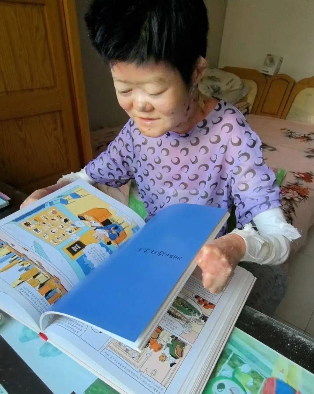 医生断言“活不过2岁”的郑州罕见病女孩<strong></p>
<p>上币费用</strong>，24岁“带伤出征”，开启西藏之行