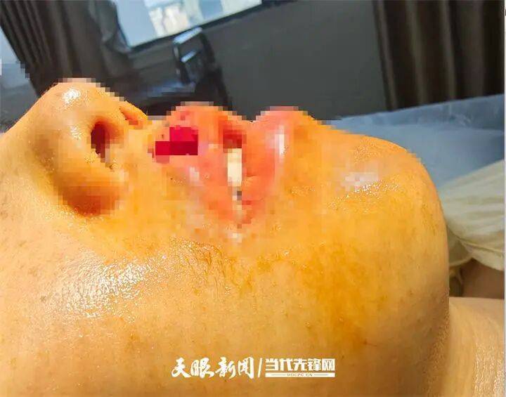 女子上门代喂被100多斤阿拉斯加犬咬伤毁容<strong></p>
<p>币特儿</strong>，牙槽骨和牙齿都被撕咬脱落，狗主人却称→