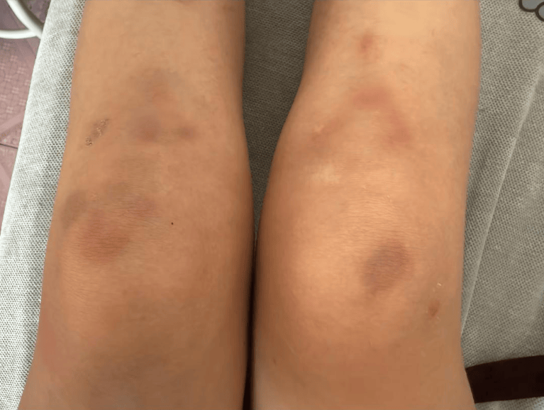 女子自称因工资问题被老板锁办公室里打 警方：双方已到派出所<strong></p>
<p>泰大币</strong>，是否打人还在调查