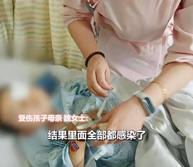 江西一5岁男孩在幼儿园被戳伤致左眼失明<strong></p>
<p>币村网</strong>，家长称老师用猪油涂抹试图消肿