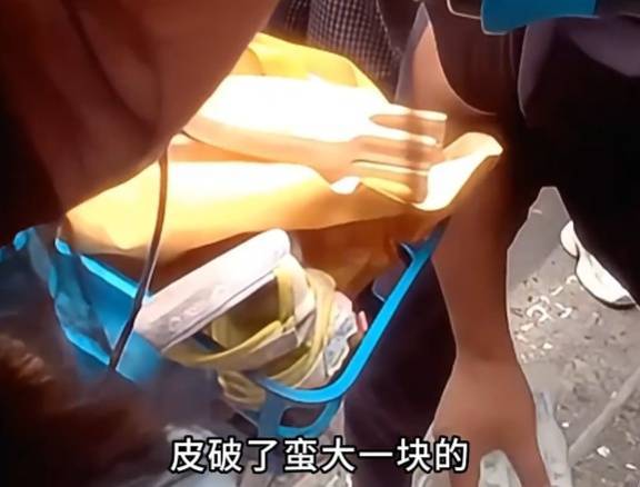 看着都疼<strong></p>
<p>九币</strong>！上海街头一男子突然求助：10岁女儿被死死卡住！这个行为太危险→