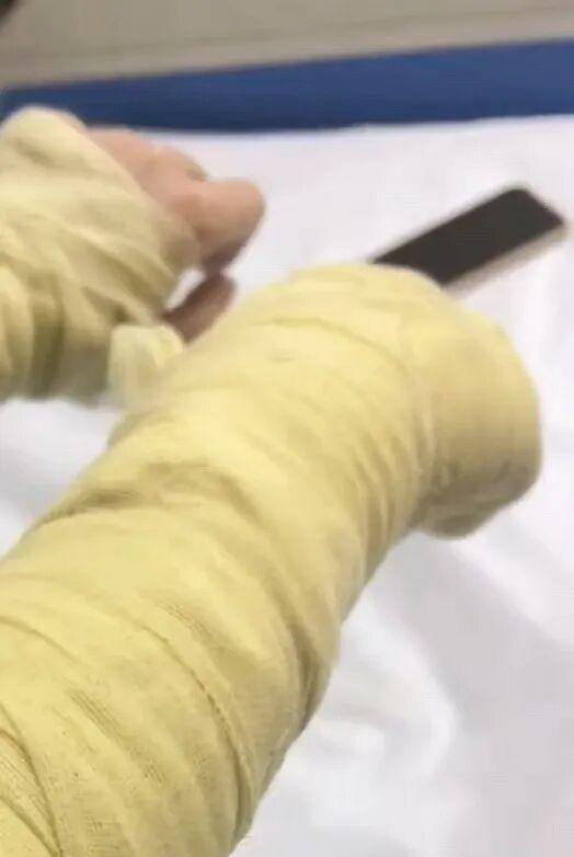 湖南一女主播被伪装的包裹炸伤<strong></p>
<p>九币</strong>，永州公安：正在核实具体情况