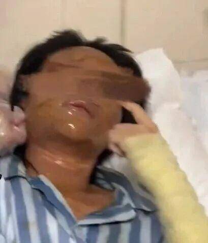 湖南一女主播被伪装的包裹炸伤<strong></p>
<p>九币</strong>，永州公安：正在核实具体情况