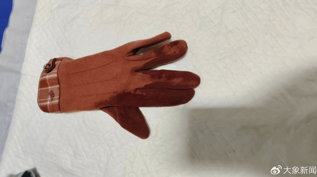 河南一男子街头挥刀乱刺<strong></p>
<p>虚拟币蜜豆</strong>，被休假女警一脚踢落凶器！女警面部缝合30余针，手套被血浸透