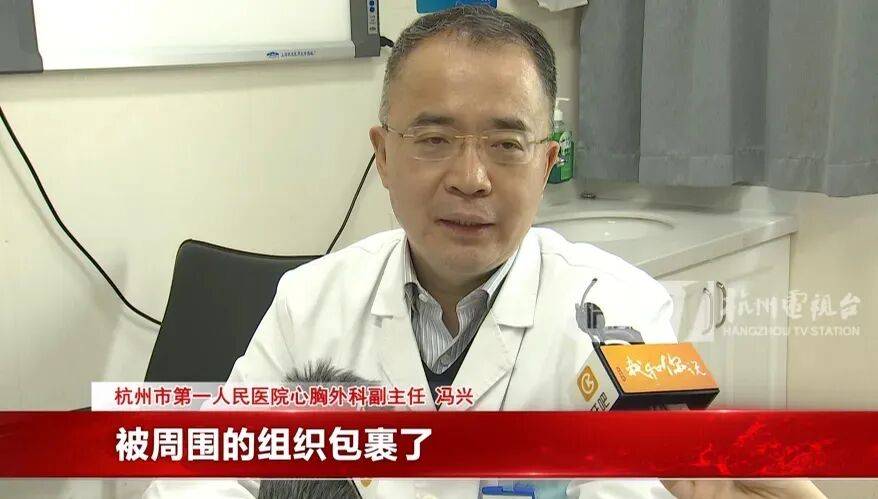 17岁小伙参军体检发现胸腔内有根5cm缝衣针<strong></p>
<p>奥德赛虚拟币</strong>，父母回忆或是1岁时扎入，取出时已锈迹斑斑